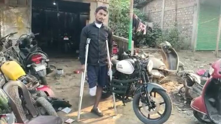 Youth Loses Leg Accident Modified Bajaj Pulsar 180 to Royal Enfield Bullet